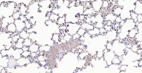 Immunohistochemical analysis of paraffin embedded mouse lung tissue slide using IHC0124M (Mouse Cathepsin L IHC Kit).