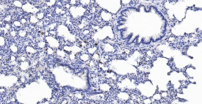Immunohistochemical analysis of paraffin embedded rat lung tissue slide using IHC0124R (Rat Cathepsin L IHC Kit).